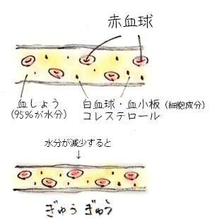 静脈血栓塞栓症